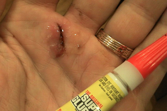 Что такое суперклей